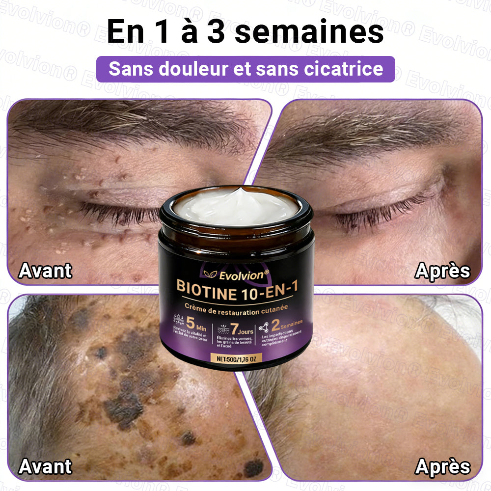 Fabriqué et expédié depuis la France ✨ Evolvion® Biotin Crème Restauratrice 10-en-1 🔥up