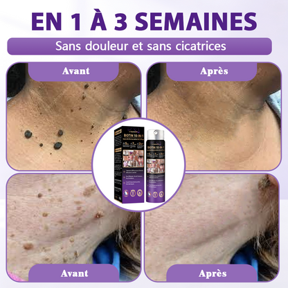 Fabriqué et expédié depuis la France ✨Spray de Restauration de la Peau Biotine 10-en-1 Evolvion®🍀
