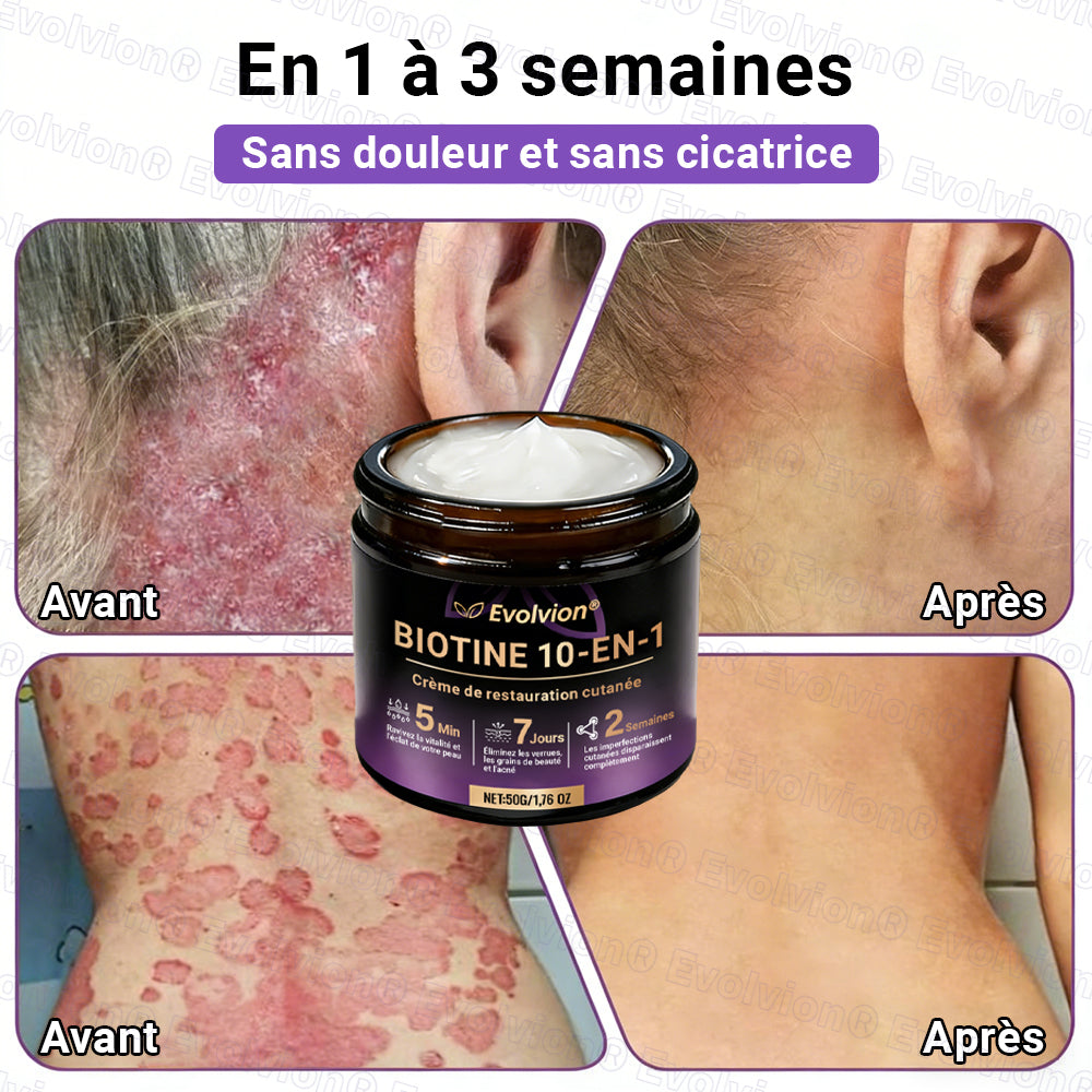 Fabriqué et expédié depuis la France ✨ Evolvion® Biotin Crème Restauratrice 10-en-1 🔥up