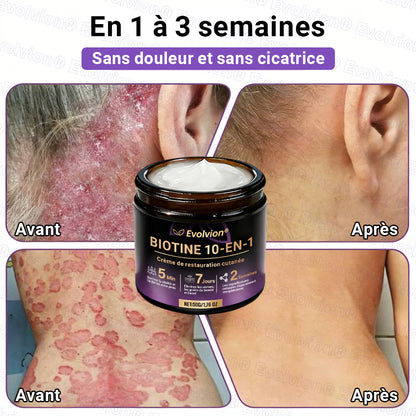 Fabriqué et expédié depuis la France ✨ Evolvion® Biotin Crème Restauratrice 10-en-1 🔥up