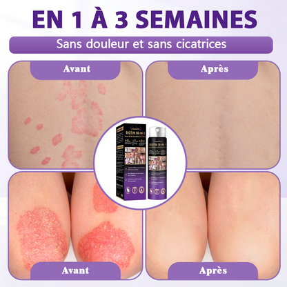 Fabriqué et expédié depuis la France ✨Spray de Restauration de la Peau Biotine 10-en-1 Evolvion®🍀