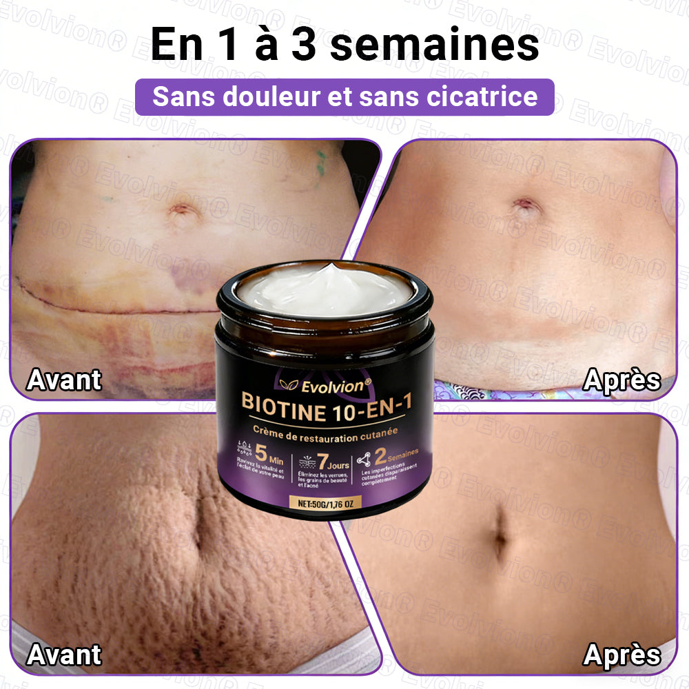 Fabriqué et expédié depuis la France ✨ Evolvion® Biotin Crème Restauratrice 10-en-1 🔥up