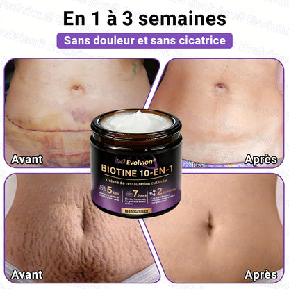 Fabriqué et expédié depuis la France ✨ Evolvion® Biotin Crème Restauratrice 10-en-1 🔥up