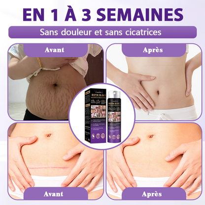 Fabriqué et expédié depuis la France ✨Spray de Restauration de la Peau Biotine 10-en-1 Evolvion®🍀