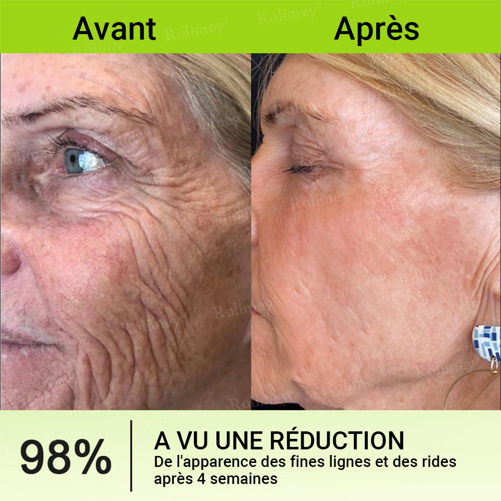 🌟👨‍⚕️ Fabriqué et expédié depuis la France 💫 Crème liftante et raffermissante anti-rides Rolimey® Botox & Vita-A Retinol Shot — Dernier jour de promotion : 70 % DE RÉDUCTION