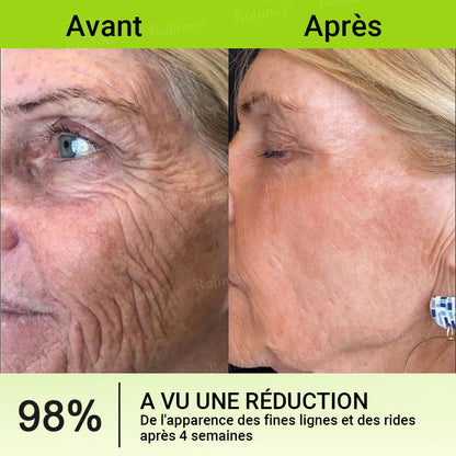 🌟👨‍⚕️ Fabriqué et expédié depuis la France 💫 Crème liftante et raffermissante anti-rides Rolimey® Botox & Vita-A Retinol Shot — Dernier jour de promotion : 70 % DE RÉDUCTION