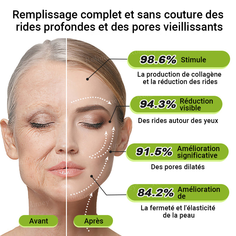🌟👨‍⚕️ Fabriqué et expédié depuis la France 💫 Crème liftante et raffermissante anti-rides Rolimey® Botox & Vita-A Retinol Shot — Dernier jour de promotion : 70 % DE RÉDUCTION