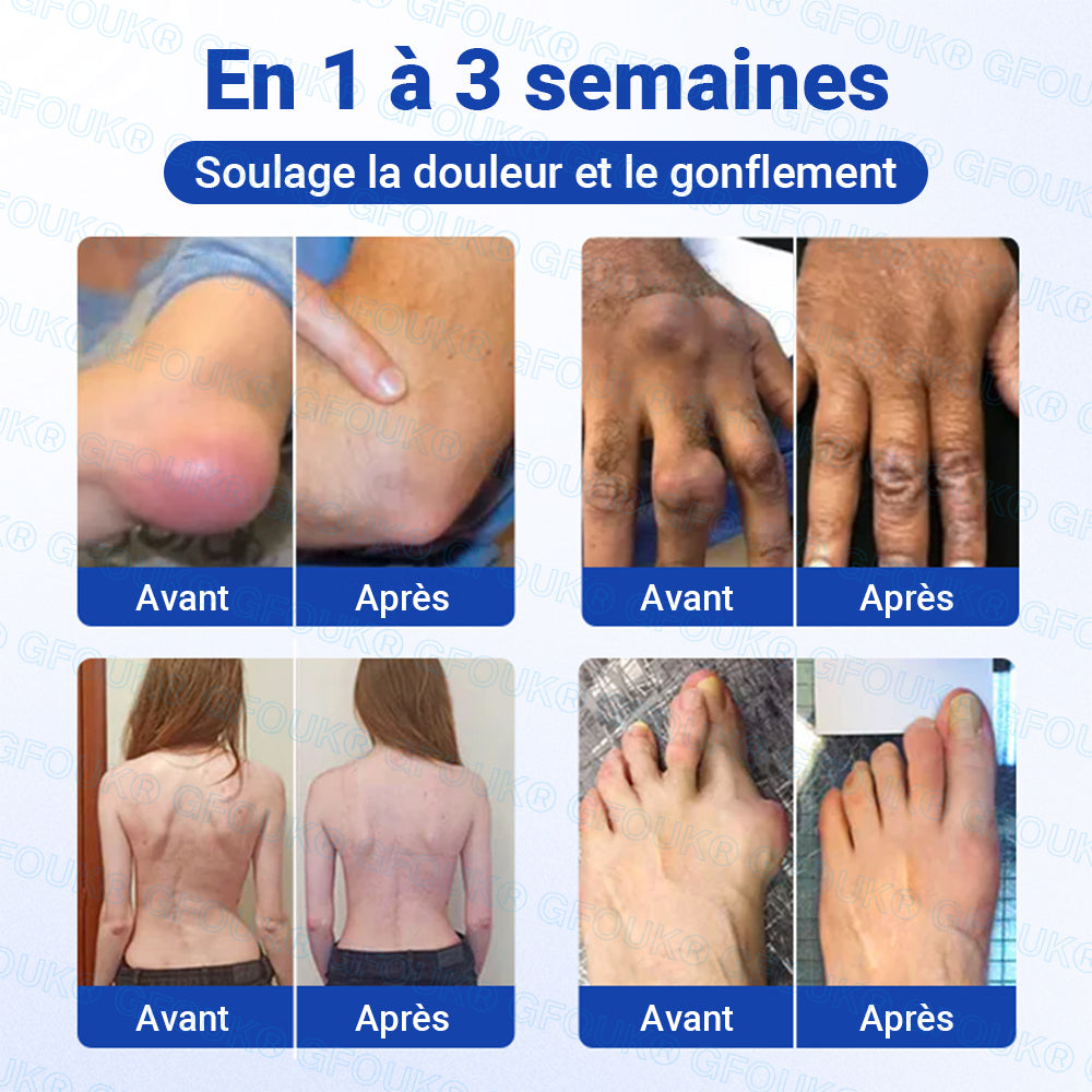Boutique Officielle 🇫🇷 | GFOUK® Gel Anti-Arthrite 10-en-1 Pénétrant et Non Gras BPC-157 × AINS (Traite l’arthrite, la neuropathie, le rhumatisme, les blessures sportives et plus encore)