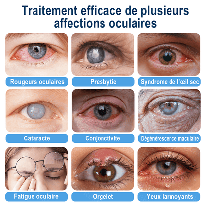 Rekulo® OptiMist Spray Oculaire ✅ Pour les yeux secs, la vision floue, la fatigue oculaire, la presbytie et la cataracte up
