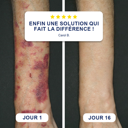 ✨ Crème Evolvion® pour la réparation des ecchymoses et le renforcement de la peau -up