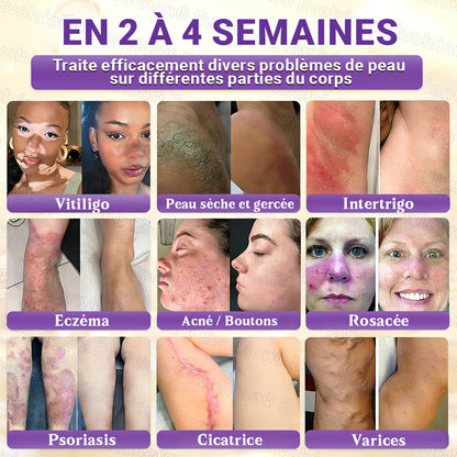 Fabriqué et expédié depuis la France ✨ Evolvion® Biotin Crème Restauratrice 10-en-1 🔥up