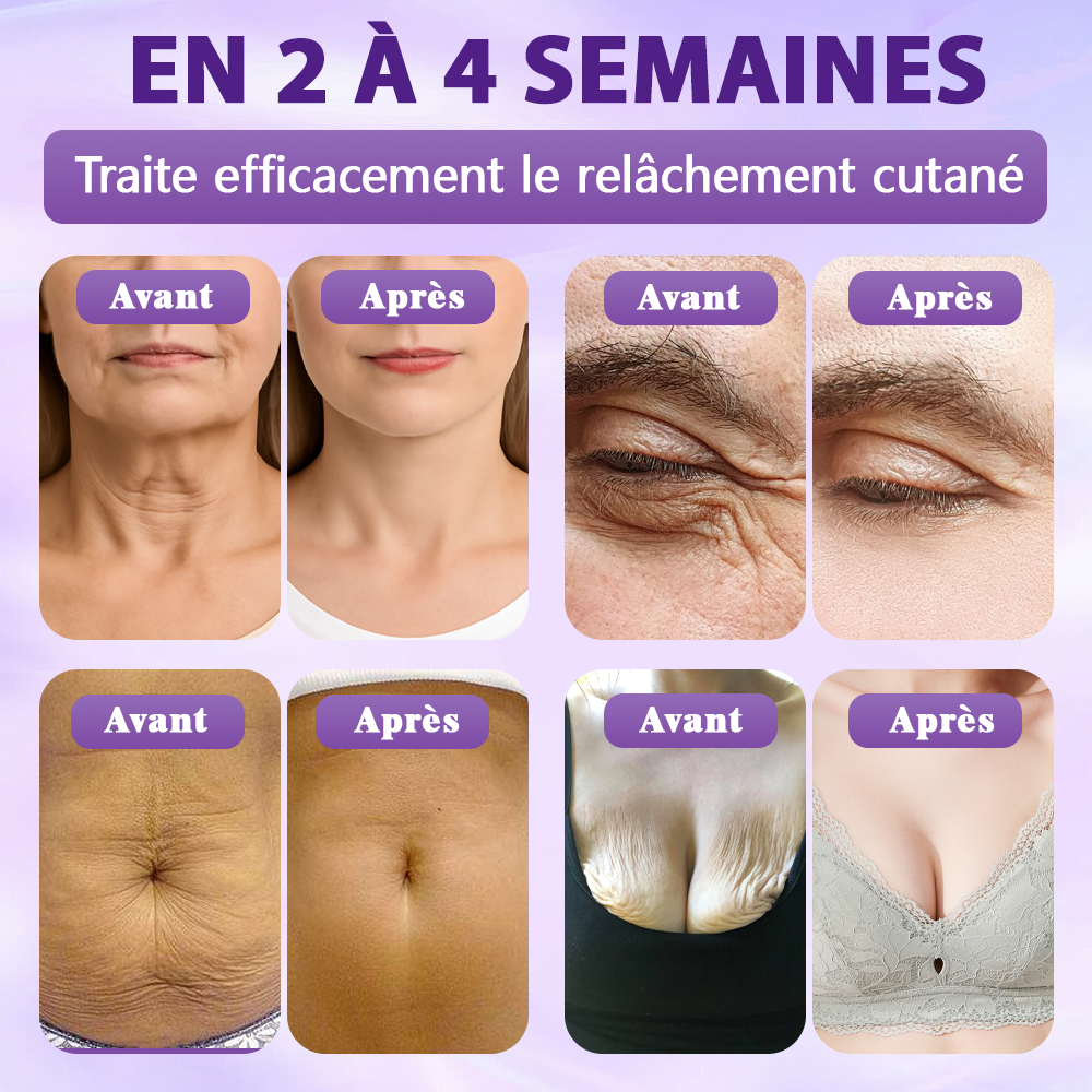 Fabriqué et expédié depuis la France ✨Spray de Restauration de la Peau Biotine 10-en-1 Evolvion®🍀