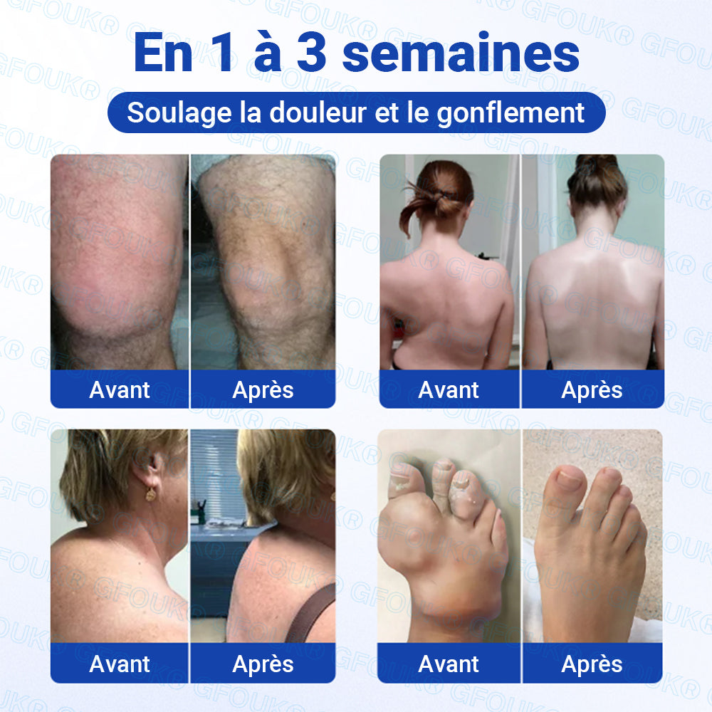 Boutique Officielle 🇫🇷 | GFOUK® Gel Anti-Arthrite 10-en-1 Pénétrant et Non Gras BPC-157 × AINS (Traite l’arthrite, la neuropathie, le rhumatisme, les blessures sportives et plus encore)