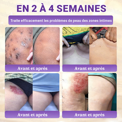 Fabriqué et expédié depuis la France ✨ Evolvion® Biotin Crème Restauratrice 10-en-1 🔥up