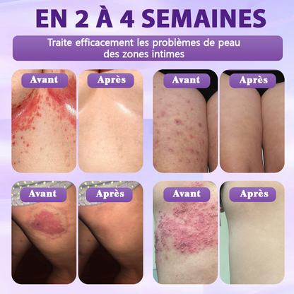 Fabriqué et expédié depuis la France ✨Spray de Restauration de la Peau Biotine 10-en-1 Evolvion®🍀