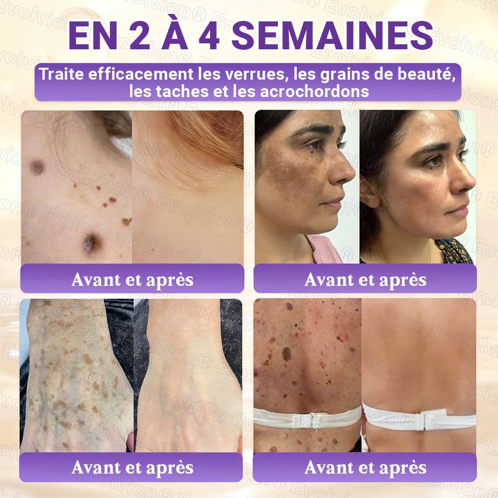 Fabriqué et expédié depuis la France ✨ Evolvion® Biotin Crème Restauratrice 10-en-1 🔥up