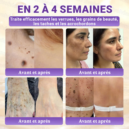 Fabriqué et expédié depuis la France ✨ Evolvion® Biotin Crème Restauratrice 10-en-1 🔥up