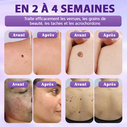 Fabriqué et expédié depuis la France ✨Spray de Restauration de la Peau Biotine 10-en-1 Evolvion®🍀