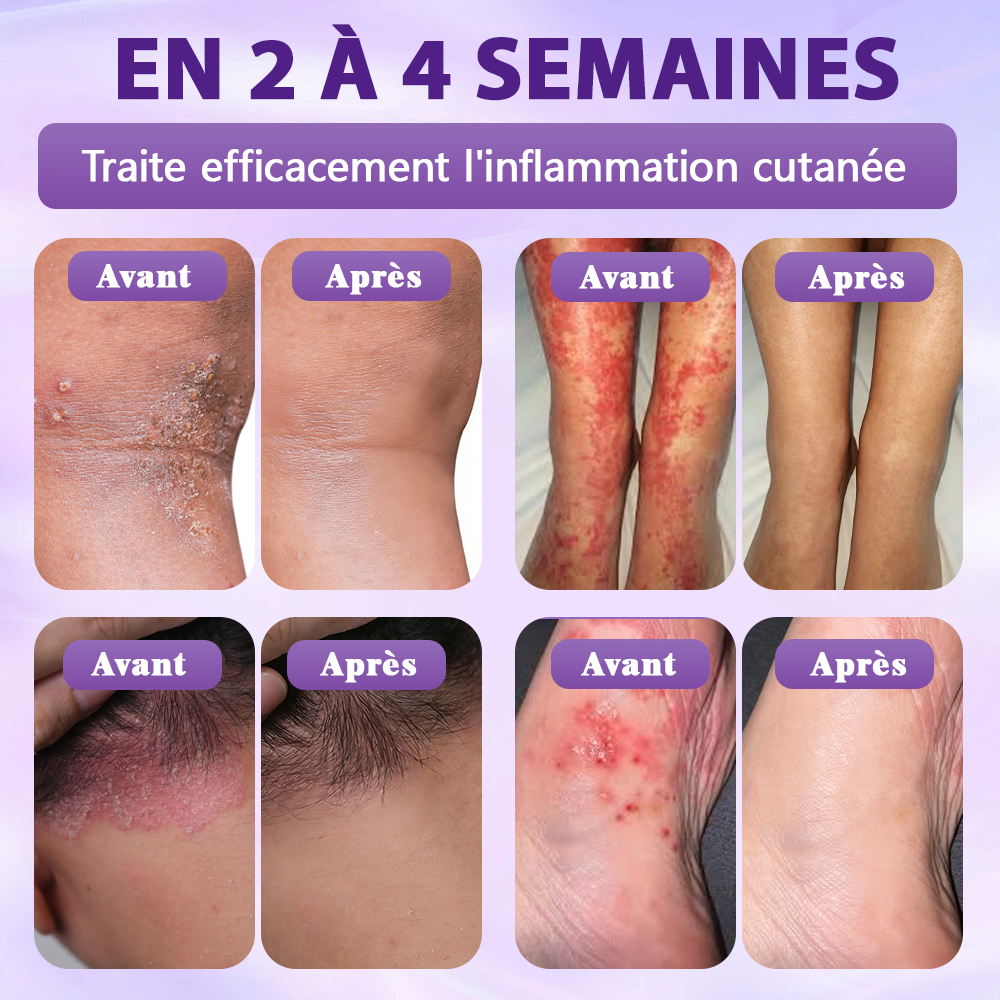 Fabriqué et expédié depuis la France ✨Spray de Restauration de la Peau Biotine 10-en-1 Evolvion®🍀