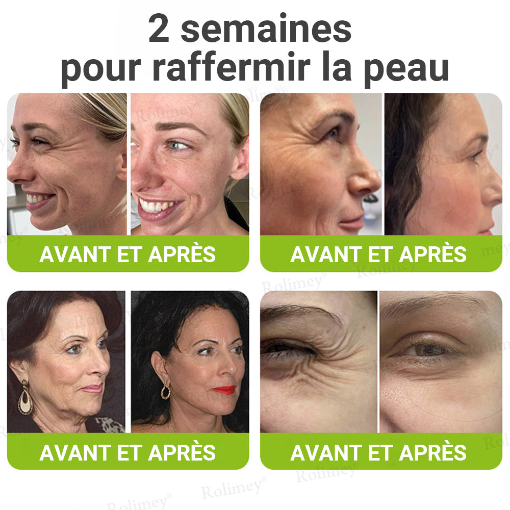 🌟👨‍⚕️ Fabriqué et expédié depuis la France 💫 Crème liftante et raffermissante anti-rides Rolimey® Botox & Vita-A Retinol Shot — Dernier jour de promotion : 70 % DE RÉDUCTION