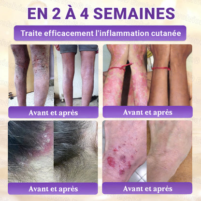 Fabriqué et expédié depuis la France ✨ Evolvion® Biotin Crème Restauratrice 10-en-1 🔥up