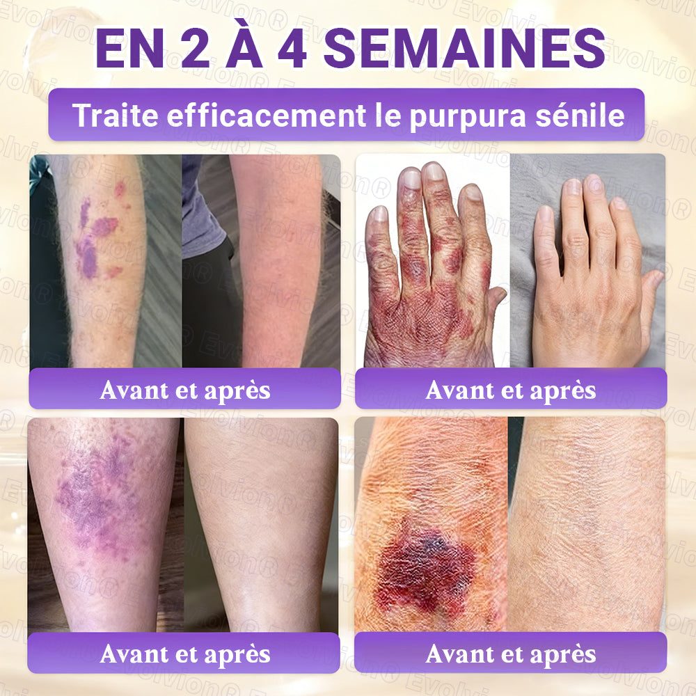 Fabriqué et expédié depuis la France ✨ Evolvion® Biotin Crème Restauratrice 10-en-1 🔥up