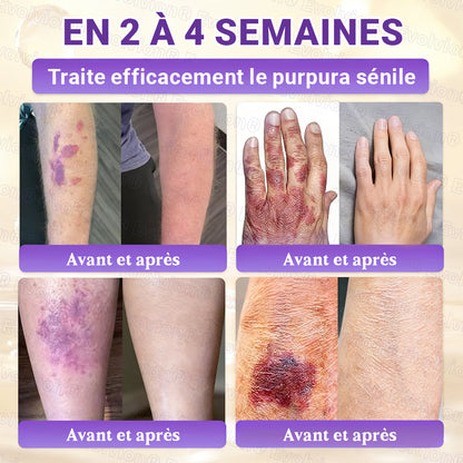 Fabriqué et expédié depuis la France ✨ Evolvion® Biotin Crème Restauratrice 10-en-1 🔥up