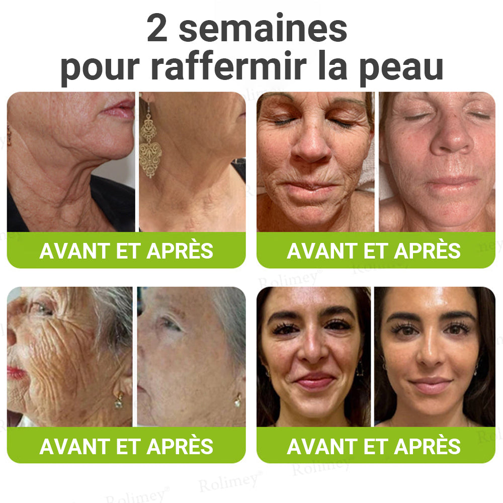 🌟👨‍⚕️ Fabriqué et expédié depuis la France 💫 Crème liftante et raffermissante anti-rides Rolimey® Botox & Vita-A Retinol Shot — Dernier jour de promotion : 70 % DE RÉDUCTION
