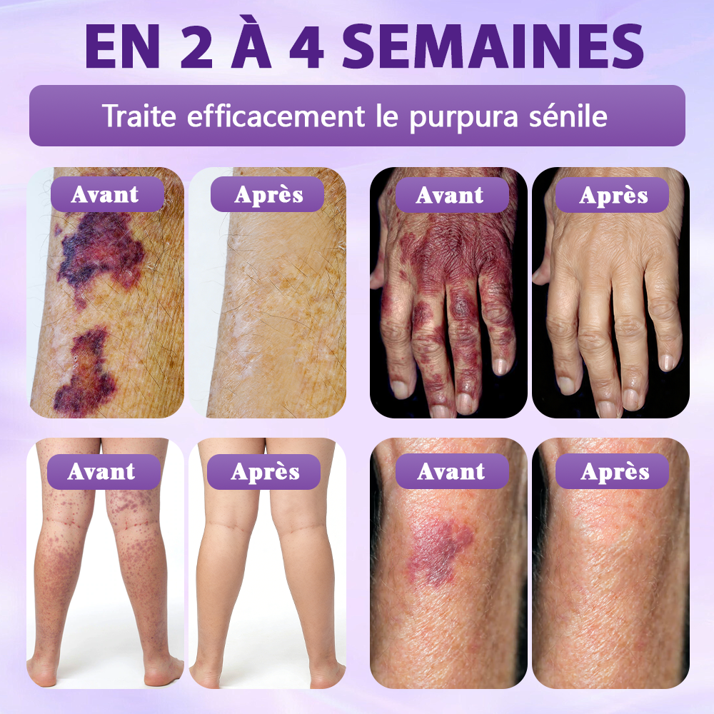 Fabriqué et expédié depuis la France ✨Spray de Restauration de la Peau Biotine 10-en-1 Evolvion®🍀