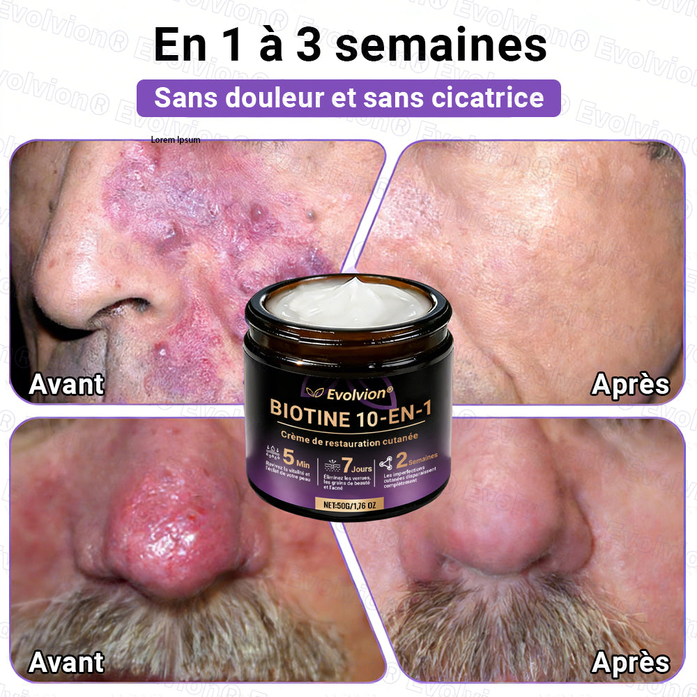 Fabriqué et expédié depuis la France ✨ Evolvion® Biotin Crème Restauratrice 10-en-1 🔥up