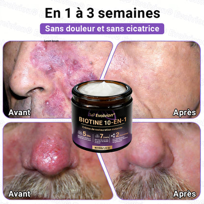 Fabriqué et expédié depuis la France ✨ Evolvion® Biotin Crème Restauratrice 10-en-1 🔥up