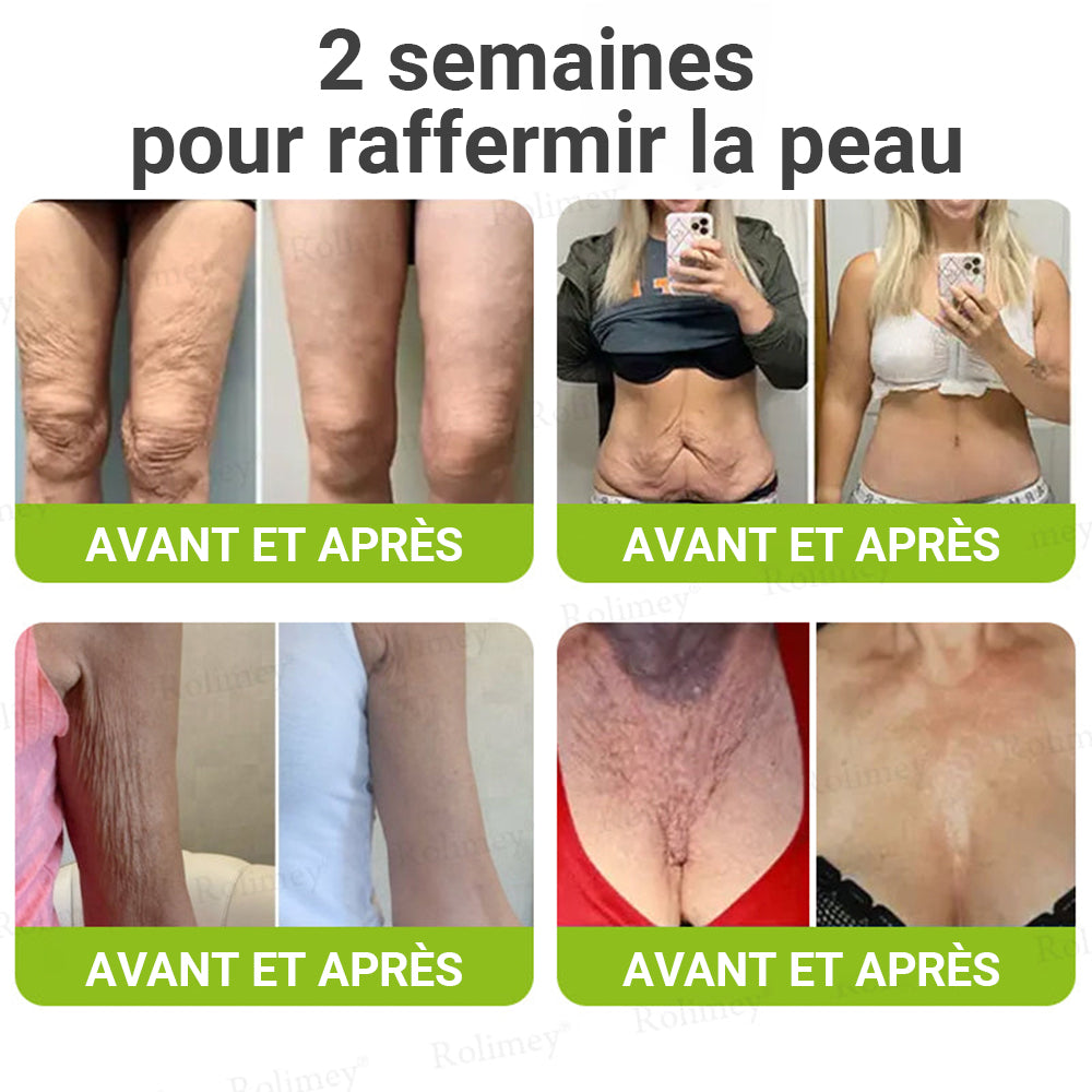 🌟👨‍⚕️ Fabriqué et expédié depuis la France 💫 Crème liftante et raffermissante anti-rides Rolimey® Botox & Vita-A Retinol Shot — Dernier jour de promotion : 70 % DE RÉDUCTION