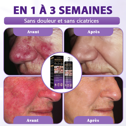 Fabriqué et expédié depuis la France ✨Spray de Restauration de la Peau Biotine 10-en-1 Evolvion®🍀