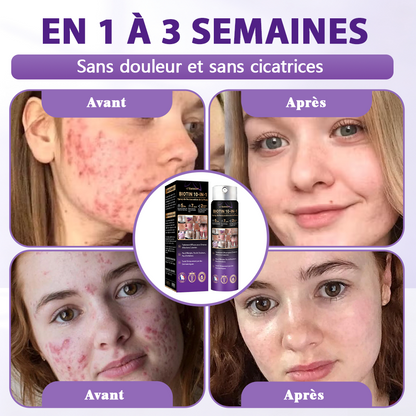 Fabriqué et expédié depuis la France ✨Spray de Restauration de la Peau Biotine 10-en-1 Evolvion®🍀