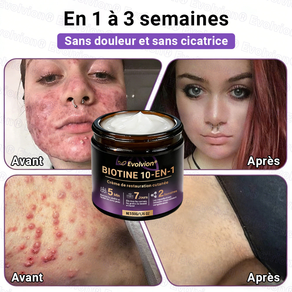 Fabriqué et expédié depuis la France ✨ Evolvion® Biotin Crème Restauratrice 10-en-1 🔥up